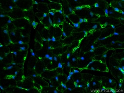 ZO-1 Rabbit Polyclonal Antibody, Proteintech:Antibodies:Primary Antibodies