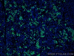 Ki-67 Rabbit Polyclonal Antibody, Proteintech:Antibodies:Primary Antibodies