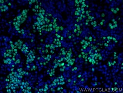 Ki-67 Rabbit Polyclonal Antibody, Proteintech:Antibodies:Primary Antibodies