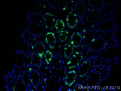 Ki-67 Rabbit Polyclonal Antibody, Proteintech:Antibodies:Primary Antibodies