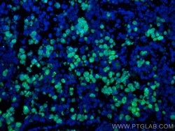 Ki-67 Rabbit Polyclonal Antibody, Proteintech:Antibodies:Primary Antibodies