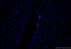 Ki-67 Rabbit Polyclonal Antibody, Proteintech:Antibodies:Primary Antibodies