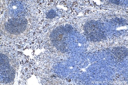 Ki-67 Rabbit Polyclonal Antibody, Proteintech:Antibodies:Primary Antibodies