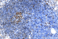 Ki-67 Rabbit Polyclonal Antibody, Proteintech:Antibodies:Primary Antibodies