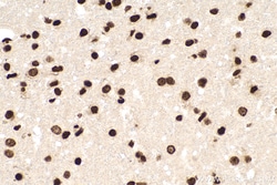 5-methylcytosine Mouse Monoclonal Antibody, Proteintech:Antibodies:Primary