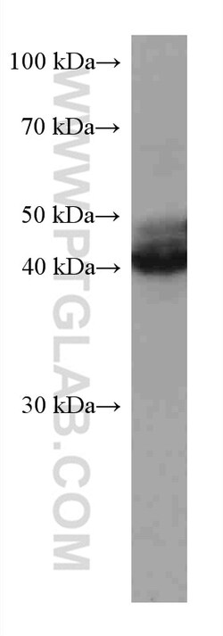Nectin-4/PVRL4 Mouse Monoclonal Antibody, Proteintech Unconjugated; 150
