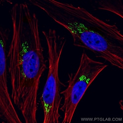 CoraLite Plus 488-conjugated p115, USO1 Rabbit Polyclonal Antibody, Proteintech:Antibodies:Primary