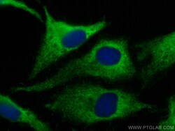 CoraLite Plus 488-conjugated p130Cas / BCAR1 Rabbit Polyclonal Antibody,