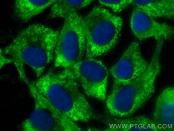CoraLite Plus 488-conjugated AMACR/p504S Mouse Monoclonal Antibody, Proteintech:Antibodies:Primary