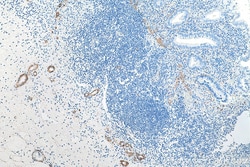 Alpha smooth muscle actin specific Mouse Monoclonal Antibody, Proteintech