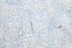 Alpha smooth muscle actin specific Mouse Monoclonal Antibody, Proteintech
