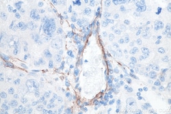 Alpha smooth muscle actin specific Mouse Monoclonal Antibody, Proteintech