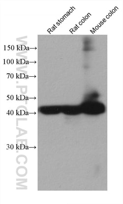 Alpha smooth muscle actin specific Mouse Monoclonal Antibody, Proteintech