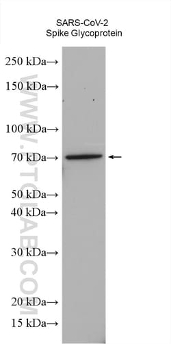 SARS-CoV-2 S protein (428-506 aa) Rabbit Polyclonal Antibody, Proteintech