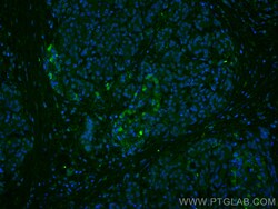 CoraLite Plus 488-conjugated ubiquitin Rabbit Polyclonal Antibody, Proteintech:Antibodies:Primary