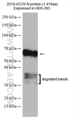 SARS-CoV-2 Nucleocapsid Phosphoprotein Rabbit Polyclonal Antibody, Proteintech:Antibodies:Primary