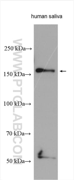 A2ML1 Rabbit Polyclonal Antibody, Proteintech:Antibodies:Primary Antibodies
