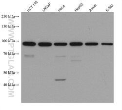 AATF Mouse Monoclonal Antibody, Proteintech:Antibodies:Primary Antibodies