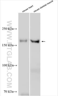 SUR2/ABCC9 Rabbit Polyclonal Antibody, Proteintech Unconjugated; 20 &mu;L:Antibodies,