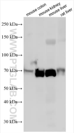 ABCD3 Rabbit Polyclonal Antibody, Proteintech:Antibodies:Primary Antibodies