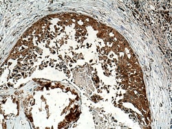 ABCE1 Rabbit Polyclonal Antibody, Proteintech:Antikörper:Primärantikörper