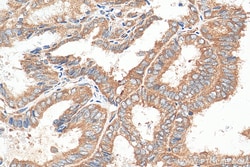 ABCE1 Rabbit Polyclonal Antibody, Proteintech:Antikörper:Primärantikörper