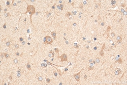 ABCE1 Rabbit Polyclonal Antibody, Proteintech:Antikörper:Primärantikörper