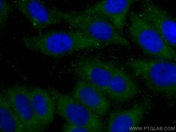 ABHD5 Mouse Monoclonal Antibody, Proteintech Unconjugated; 150 &mu;L:Antibodies,