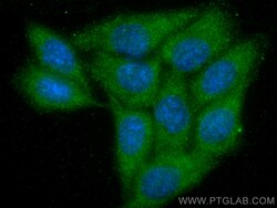 ABL1 Mouse Monoclonal Antibody, Proteintech Unconjugated; 20 &mu;L:Antibodies,