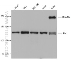 ABL1 Mouse Monoclonal Antibody, Proteintech Unconjugated; 20 &mu;L:Antibodies,