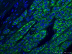ACADM Mouse Monoclonal Antibody, Proteintech:Antibodies:Primary Antibodies