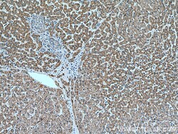 ACADM Mouse Monoclonal Antibody, Proteintech:Antibodies:Primary Antibodies