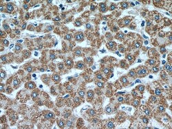 ACADM Mouse Monoclonal Antibody, Proteintech:Antibodies:Primary Antibodies