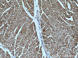 ACADM Mouse Monoclonal Antibody, Proteintech:Antibodies:Primary Antibodies