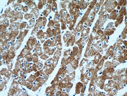 ACADM Mouse Monoclonal Antibody, Proteintech:Antibodies:Primary Antibodies