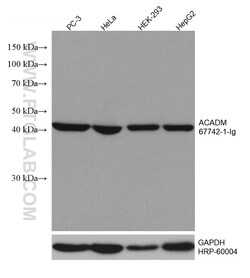 ACADM Mouse Monoclonal Antibody, Proteintech:Antibodies:Primary Antibodies