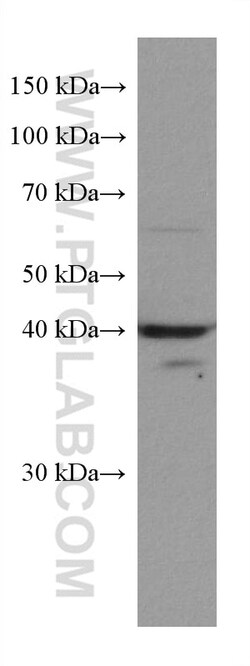 ACADM Mouse Monoclonal Antibody, Proteintech:Antibodies:Primary Antibodies