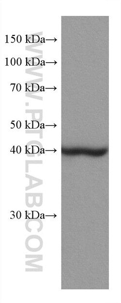 ACADM Mouse Monoclonal Antibody, Proteintech:Antibodies:Primary Antibodies