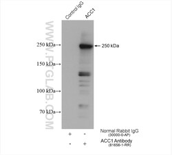 ACC1 Rabbit Recombinant Antibody, Proteintech:Antibodies:Primary Antibodies