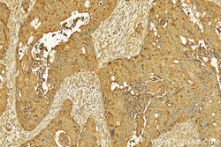 ACE2 Rabbit Polyclonal Antibody, Proteintech:Antibodies:Primary Antibodies