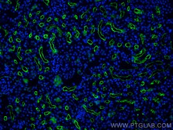 ACE2 Rabbit Polyclonal Antibody, Proteintech:Antibodies:Primary Antibodies