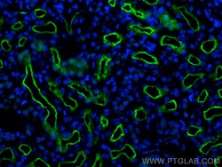 ACE2 Rabbit Polyclonal Antibody, Proteintech:Antibodies:Primary Antibodies