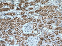 ACE2 Rabbit Polyclonal Antibody, Proteintech:Antibodies:Primary Antibodies