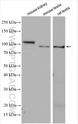 ACE2 Rabbit Polyclonal Antibody, Proteintech:Antibodies:Primary Antibodies