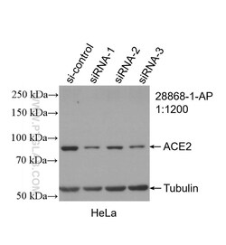 ACE2 Rabbit Polyclonal Antibody, Proteintech:Antibodies:Primary Antibodies