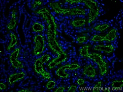ACE2 Rabbit Recombinant Antibody, Proteintech Unconjugated; 20 &mu;L:Antibodies