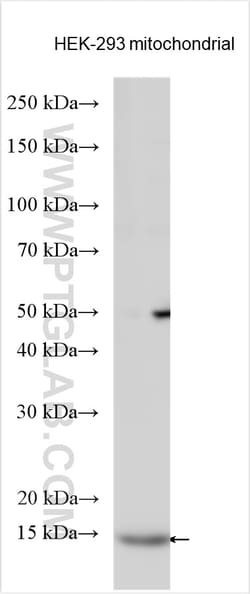 ACN9 Rabbit Polyclonal Antibody, Proteintech 150 &mu;L | Buy Online | Proteintech | Fisher Scientific