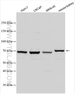 ACSL3 Rabbit Polyclonal Antibody, Proteintech:Antibodies:Primary Antibodies
