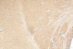 ACTR3B Mouse Monoclonal Antibody, Proteintech Unconjugated; 150 &mu;L:Antibodies,