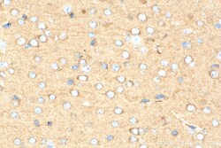 ACTR3B Mouse Monoclonal Antibody, Proteintech Unconjugated; 150 &mu;L:Antibodies,